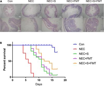 Multiomics Study Reveals Enterococcus and Subdoligranulum Are Beneficial to Necrotizing Enterocolitis